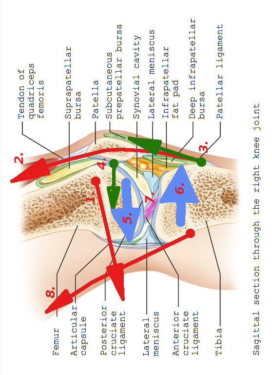 1. Reiden paino + pakaravoimat<br />2. Polven ojentajan voima<br />3. Lumpion takia ojentajan voima kohdistuu yläviistoon<br />4. Lumpio painaa reisiluun päätä alas<br />5. ja 6. Polvinivel kuormittuu<br />7. Ristiside kuormittuu<br />8. Polven koukistaja kompensoi